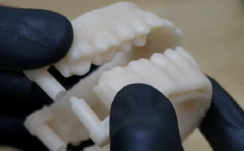 Fogászat - Ilyen előnyökkel jár a 3D nyomtatás a hagyományos módszerekkel szemben