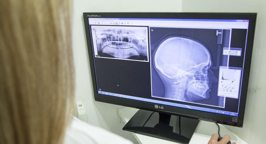 Fogászati röntgennel nemet is azonosít a mesterséges intelligencia 