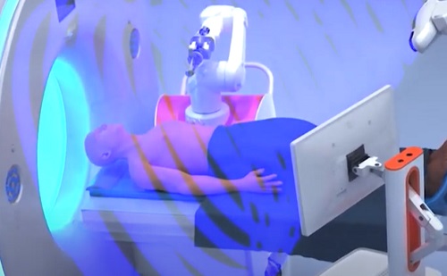Már beszerezhető a nem operálható daganatokat kezelő robot