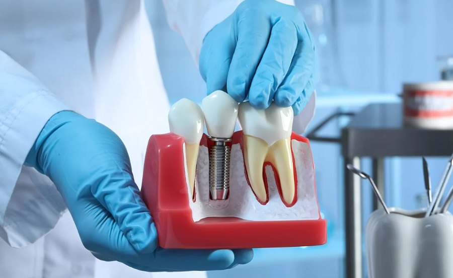 A fogászatban is pontosabbá és hatékonyabbá teszi a kezeléseket a technológia