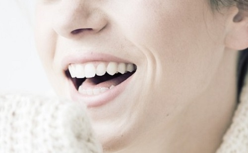 Természetes hatás és tartósság – 3 ok, amiért érdemes fogászati implantátumot beültetni