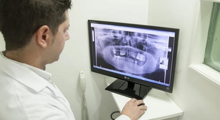 Röntgen a fogorvosnál? Biztonságosabb, mint hinnénk