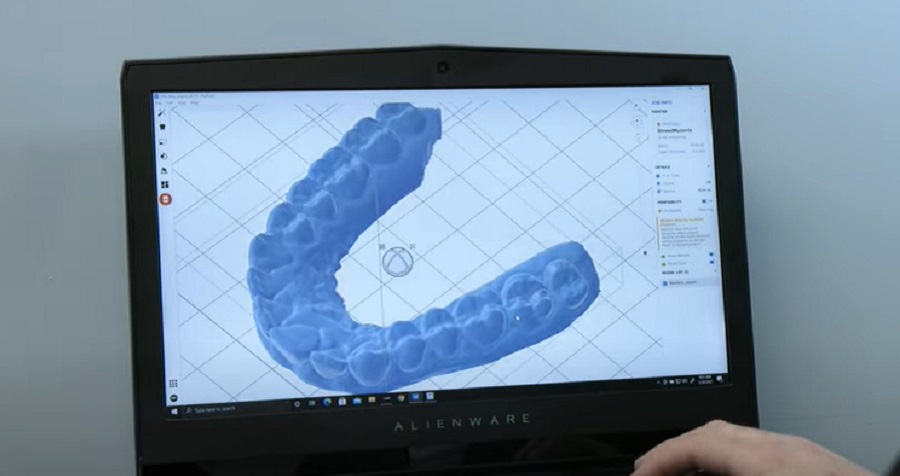 A technológia beépítése komoly előrelépést jelent a fogászat területén is