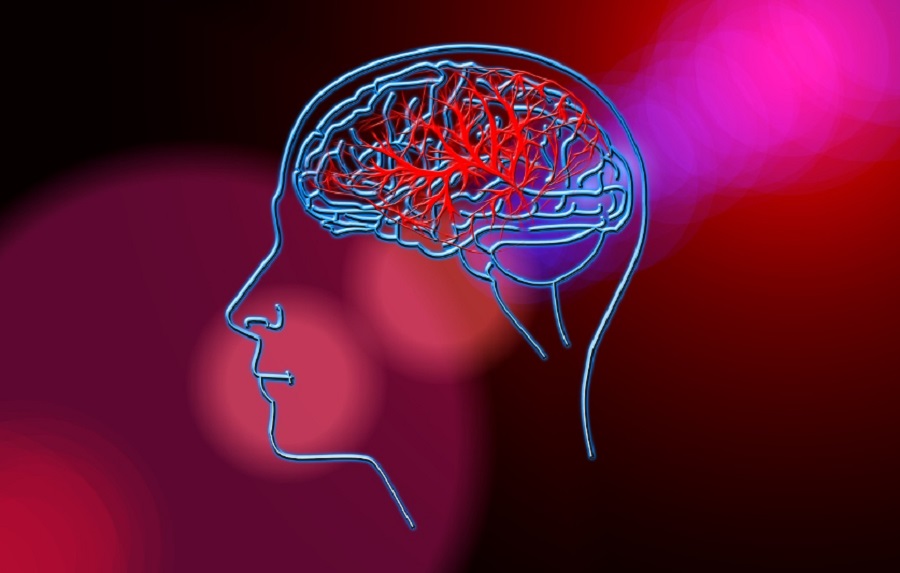 Intelligens agyhullám-sapka képes diagnosztizálni a stroke-ot
