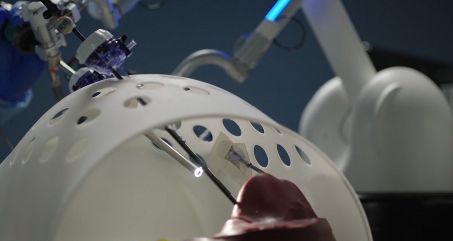 Engedélyt kapott a frissített Maestro sebészeti robot
