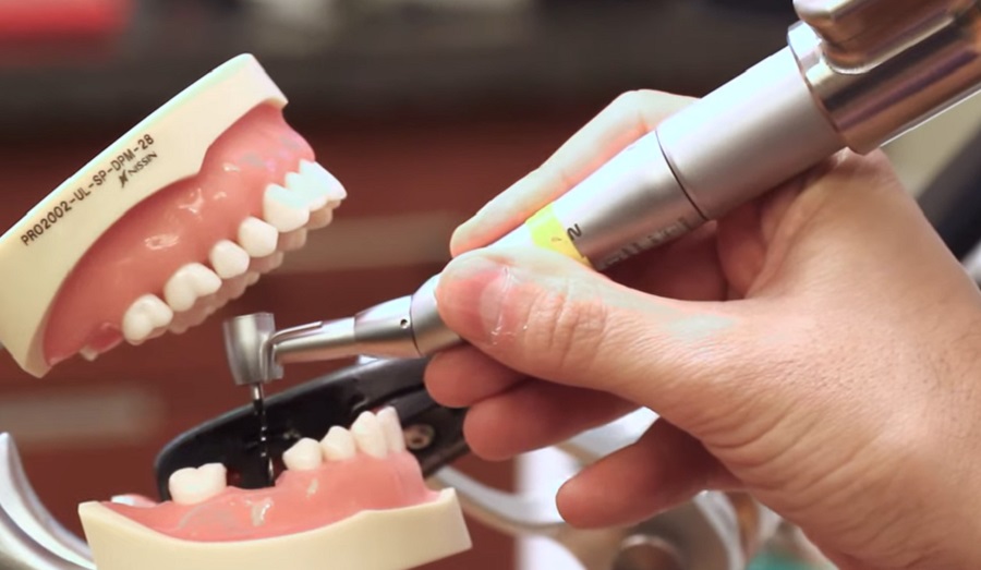 A robot-asszisztált fogimplantátum-kezelés rendkívüli pontosságot kínál