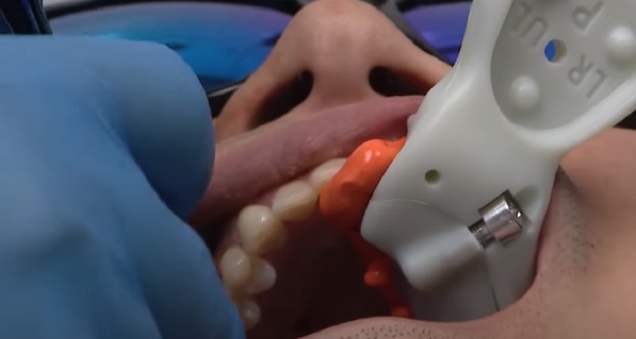 Seb- és fájdalom nélküliségre törekszik a modern fogászat