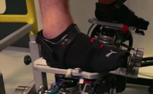 Robottechnológiával négy karral végezhetnek a sebészek műtétet