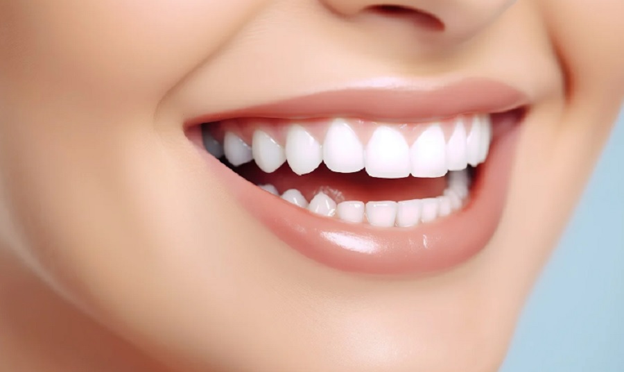 Fogtisztítás - A fogak tökéletesen néznek ki, de egy ideig érzékenyek lehetnek