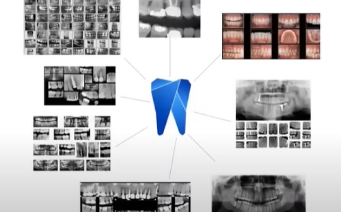 Okosabb diagnosztikai eszközök a fogászatban - mesterséges intelligenciával