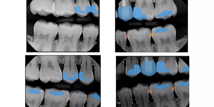 Okosabb diagnosztikai eszközök a fogászatban - mesterséges intelligenciával