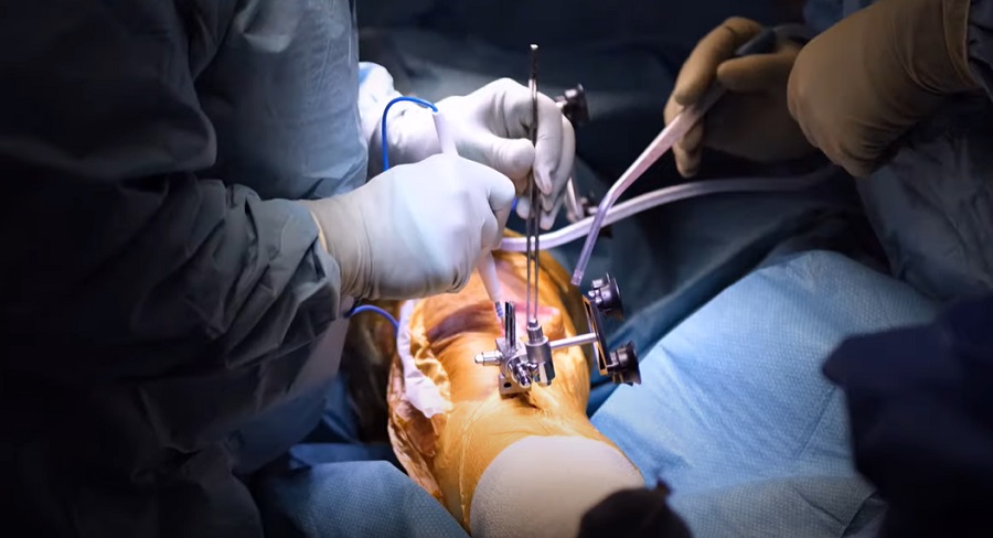 Új ízületpótlási technológiával rukkol elő a Mako sebészeti robot