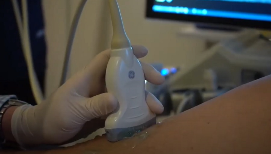 Az ultrahangos irányított szkleroterápia előkészítése