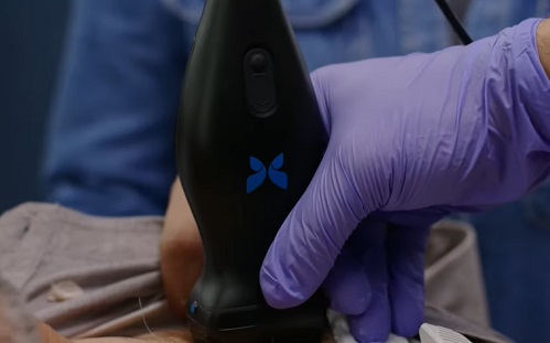 Chipes ultrahang technológia érkezik a sebészeti robotikába