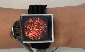 A vérerekről is képet készít egy új, csúcstechnológiás óra