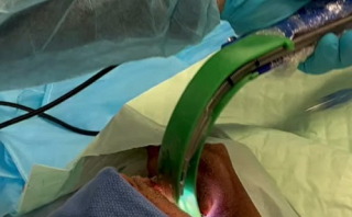 Intubálni is tud egy robot – bármilyen nehéz eset a beteg