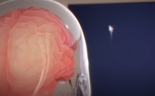 Mesterséges intelligencia - Elon Musk agyi chipjét használja videókészítéshez egy ALS-es beteg
