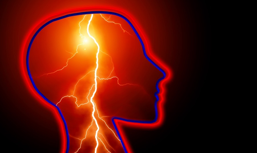 Segíthet a mesterséges intelligencia a következő stroke megelőzésében?