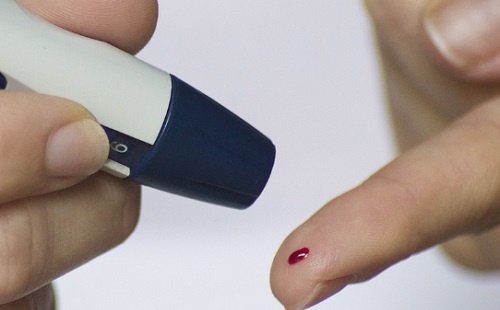 Cukorbetegség szöveti jellemzőit dekódolja a mesterséges intelligencia